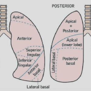 Other opportunistic moulds: aspergillosis
