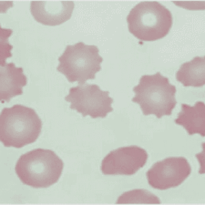 Roles of epidemiological modelling